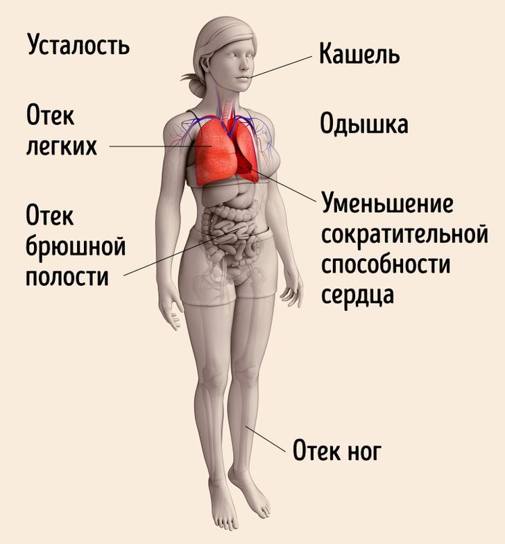 Застойная сердечная недостаточность и болезни сердца
