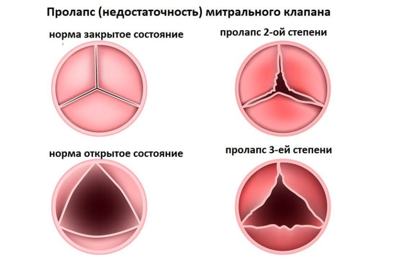 Классификация МК